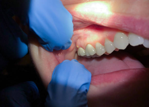 Best After-Hours Emergency Dentist in Crosspointe, VA