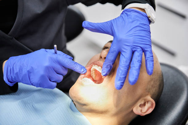 Best Emergency Dental Surgery in Crosspointe, VA